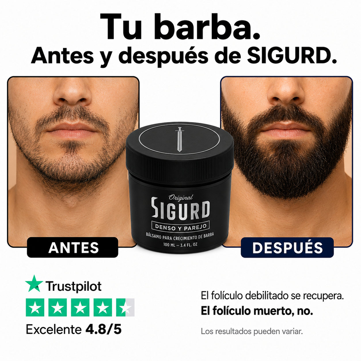 SIGURD® Bálsamo para Crecimiento de Barba