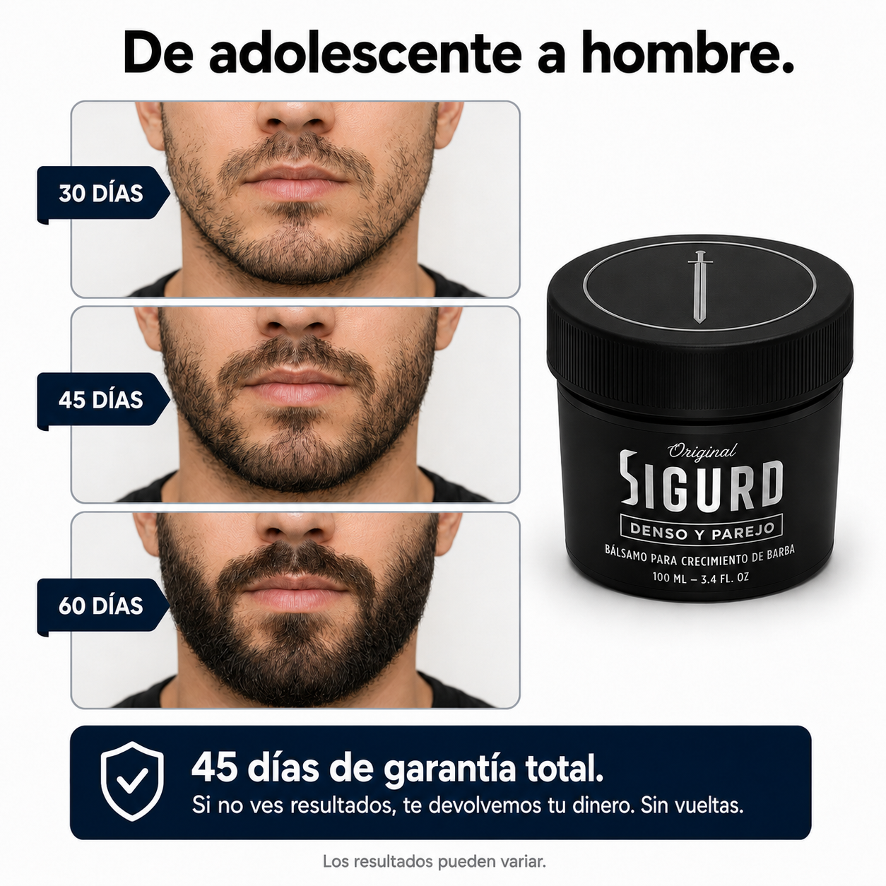 SIGURD® Bálsamo para Crecimiento de Barba